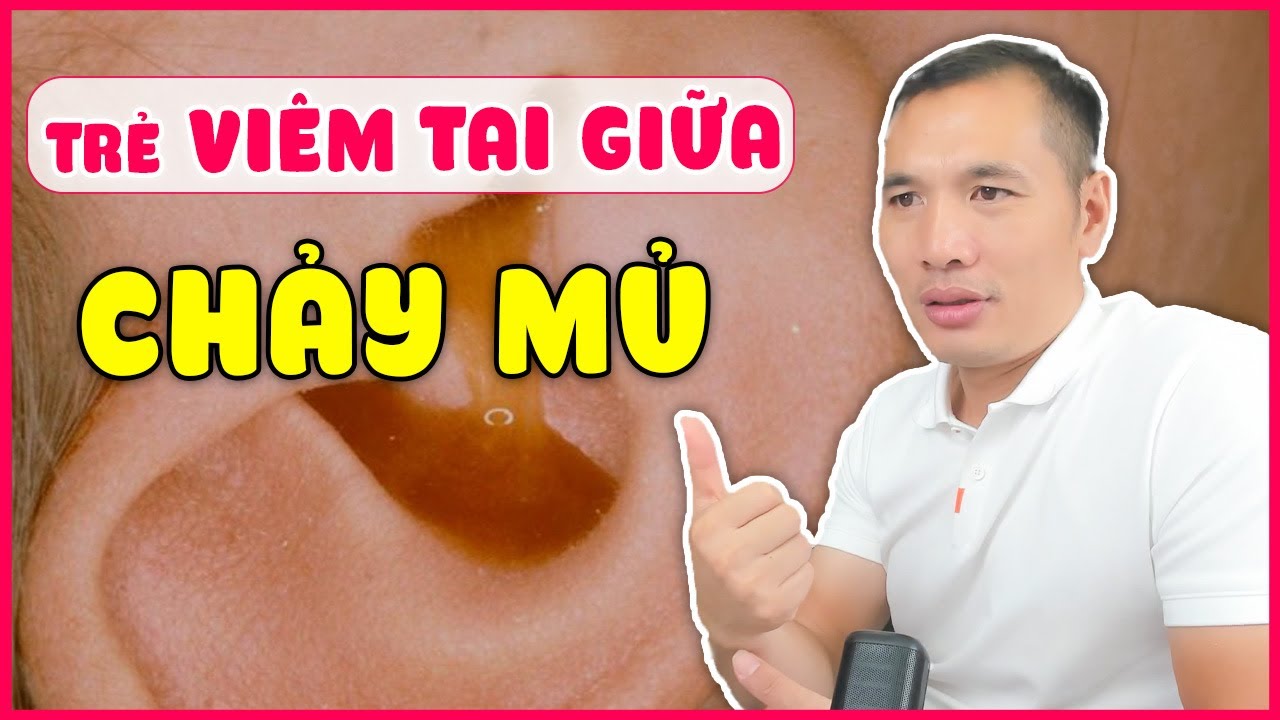 TRẺ VIÊM TAI GIỮA - Nguyên nhân, dấu hiệu, cách xử lí, tránh TÁI ĐI TÁI LẠI| Dược sĩ Trương Minh Đạt