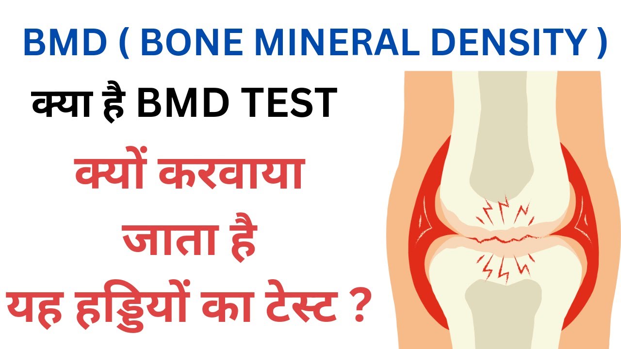 BMD-Bone Mineral Density Test क्यों करवाया जाता है ?