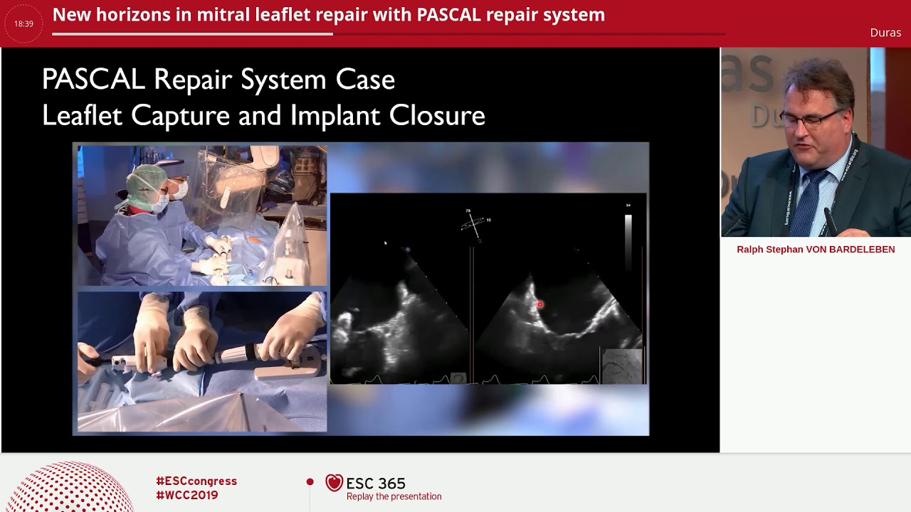 PASCAL repair system - New Horizons in mitral leaflet repair | Edwards Lifesciences symposium at ESC