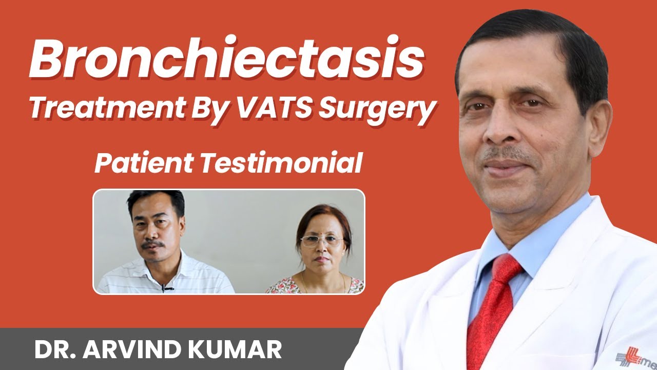 Bronchiectasis का सफल इलाज VATS (दूरबीन वाली सर्जरी) के द्वारा | Prof. (Dr.) Arvind Kumar