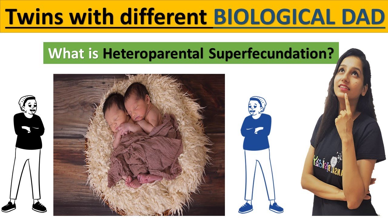 Heteropaternal Superfecundation I Twins with different biological father I