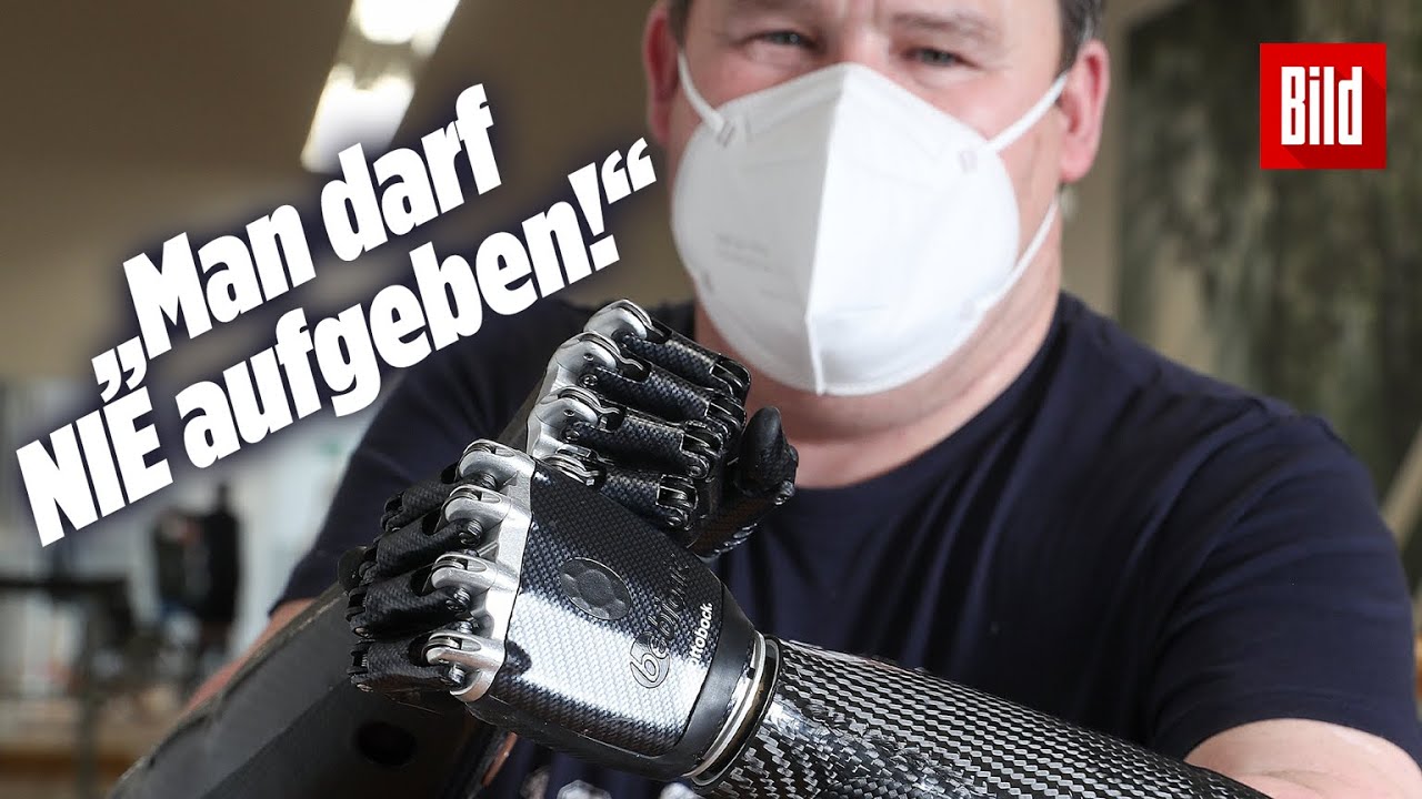 Hände und Füße amputiert: Hightech-Prothesen schenken Victor neues Leben