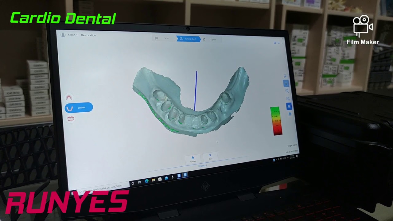 Runyes IOS Part 4/4 - Implants