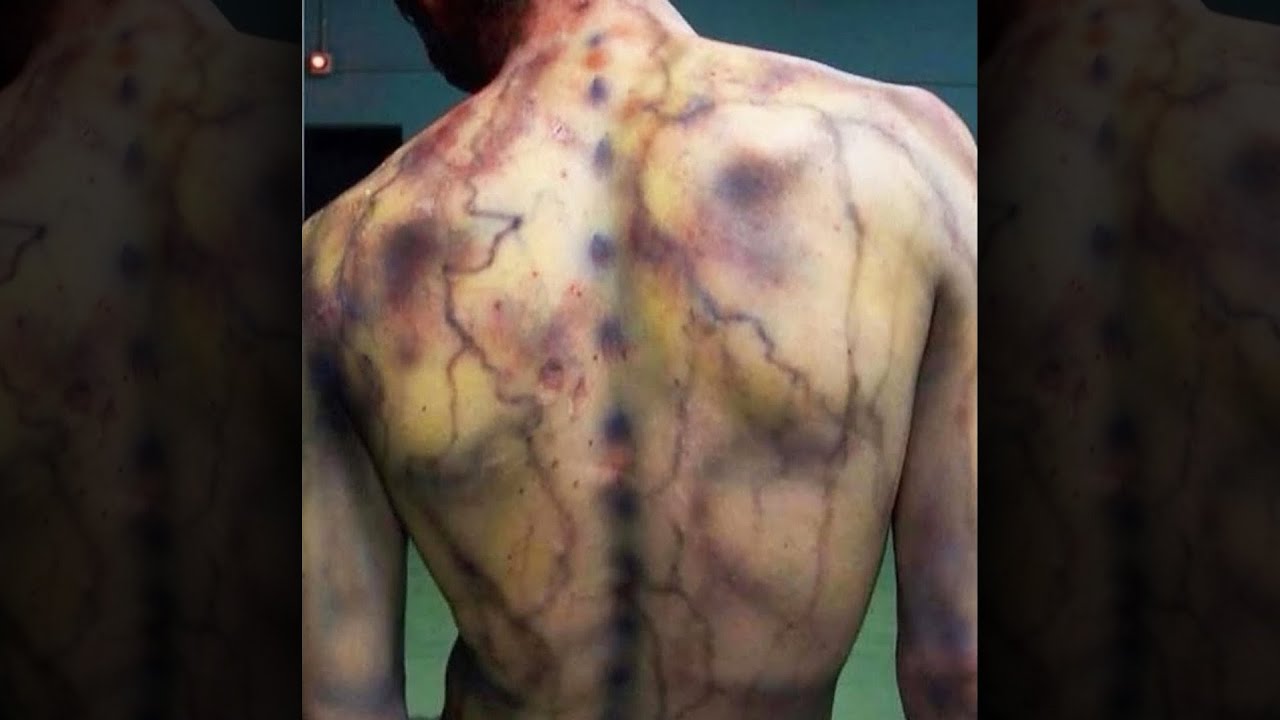 Bros Got Struck By Lightning...😳