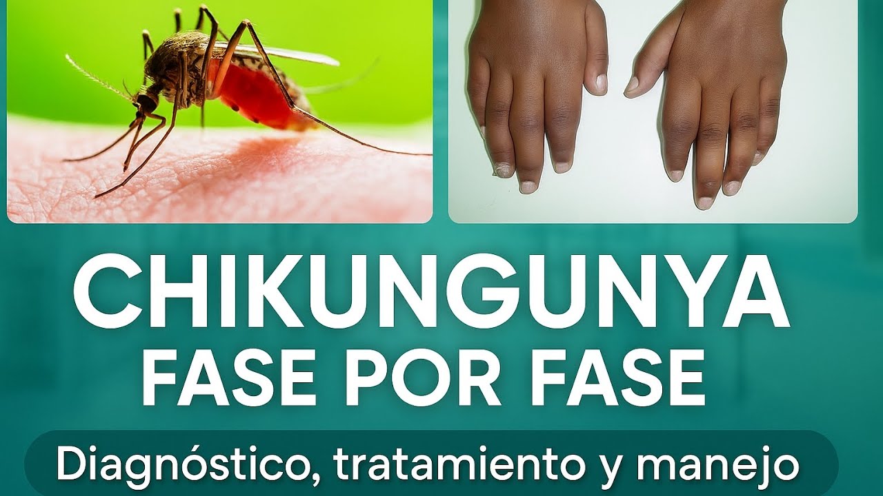 “CHIKUNGUNYA: El virus que deja secuelas por años 😱 Síntomas, manejo y prevención” #mosquito #dengue