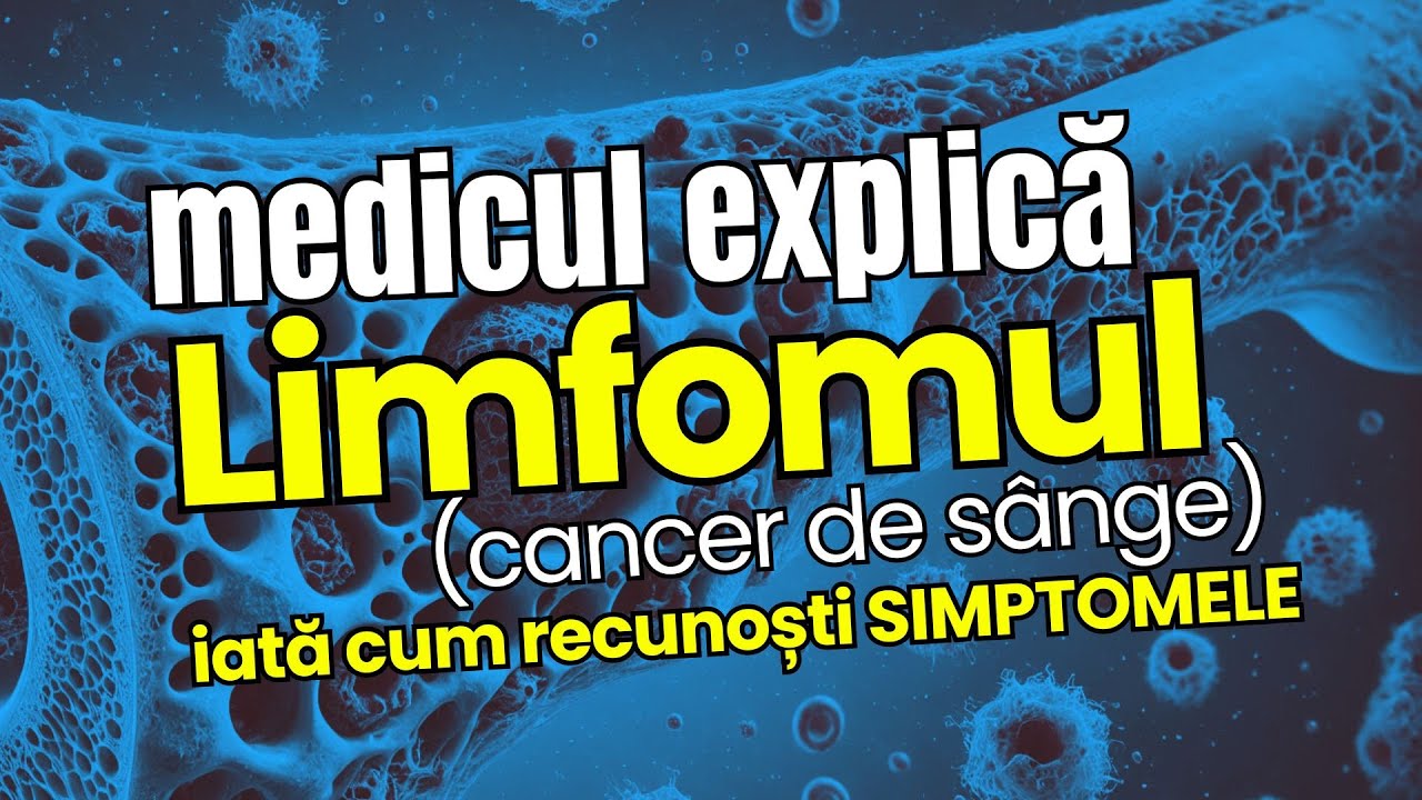 Totul despre LIMFOM: Medicul Explică simptomele și tratamentul
