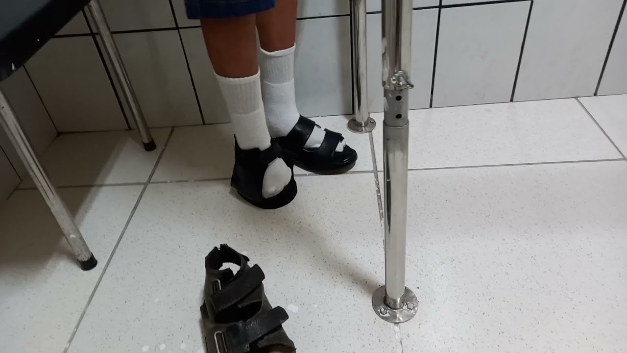 Pé amputado devido o diabetes, nova sandália com palmilha especial #diabetes #dicas #share