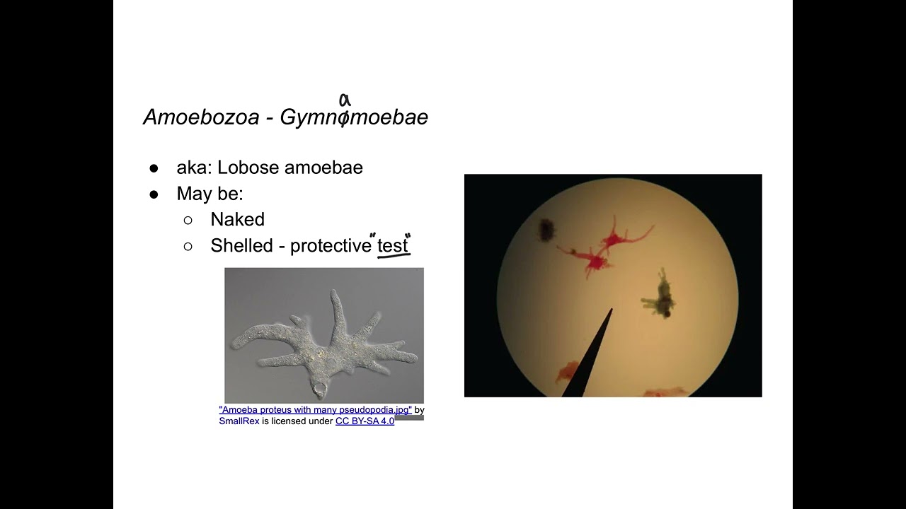 Protists - Amoebozoa