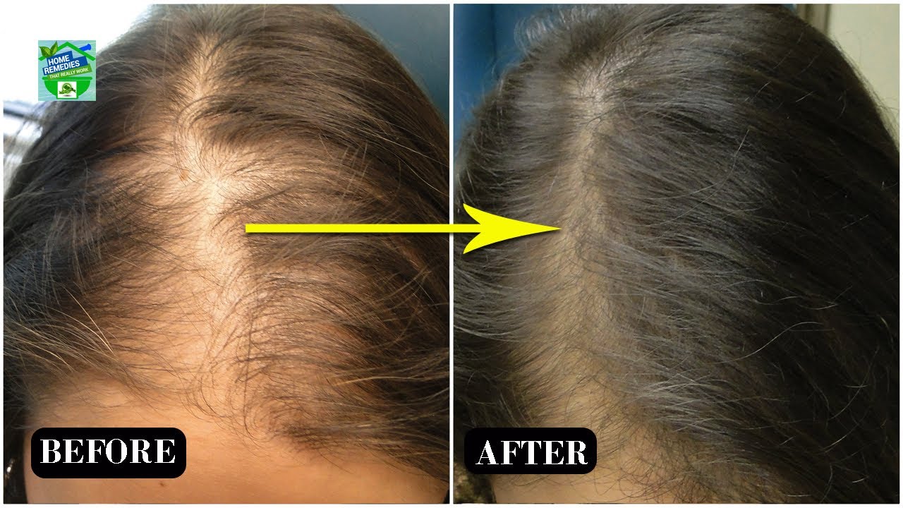How To Use Ginger To Stimulate Hair Growth