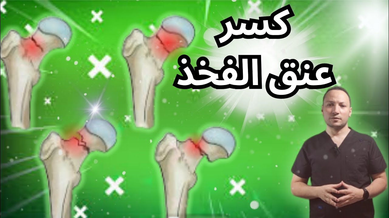 كسر عنق عظمة الفخذ وومضاعفات الكسر وعلاجه