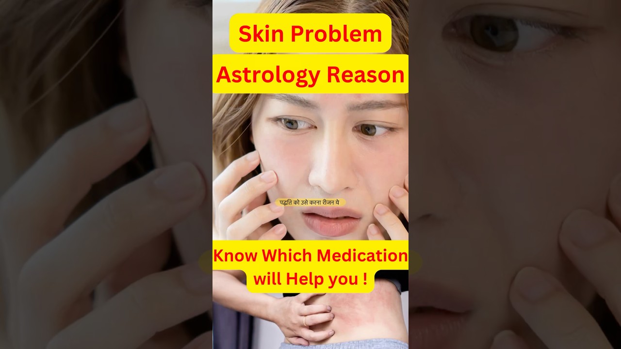 Astrology Remedy for Skin Problem #skincare #skin #astrology #astrotipforskin #dskastrology #astro