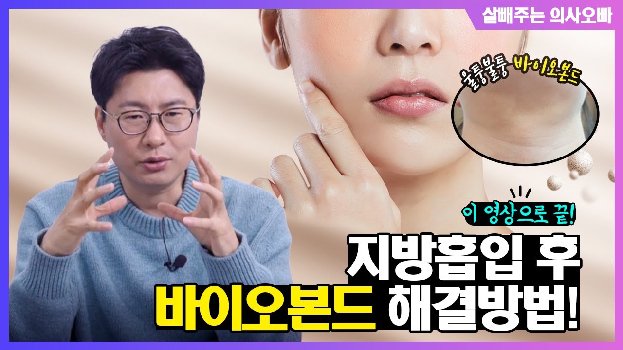 지방흡입 후 바이오본드 해결 방법 이 영상으로 끝!