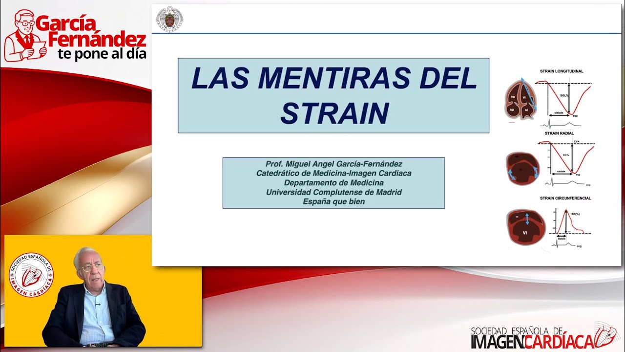 Las mentiras del Strain
