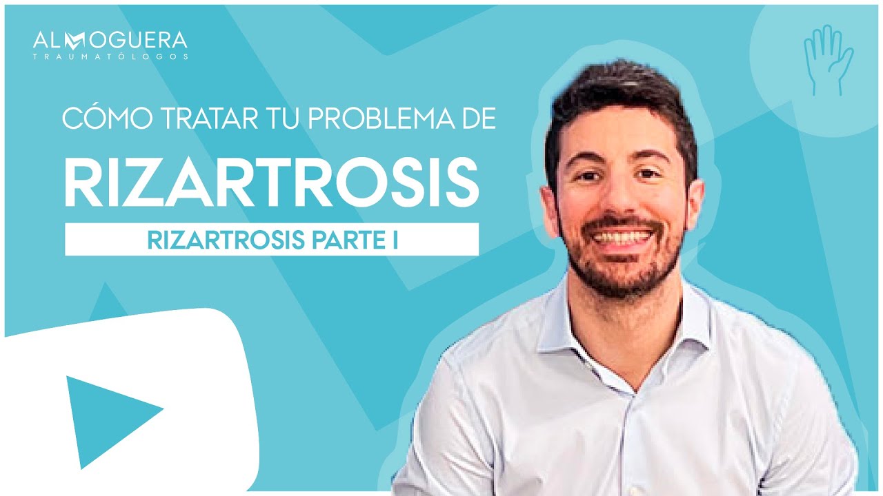 Rizartrosis: Qu&eacute; es la rizartrosis del pulgar, diagn&oacute;stico y tratamientos