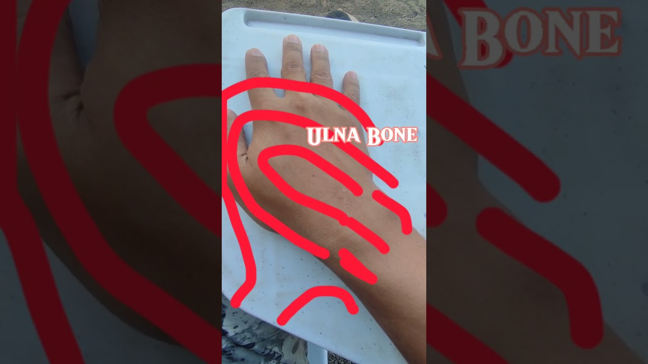 Fingerprint Pattern Radial loop Vs Ulnar loop