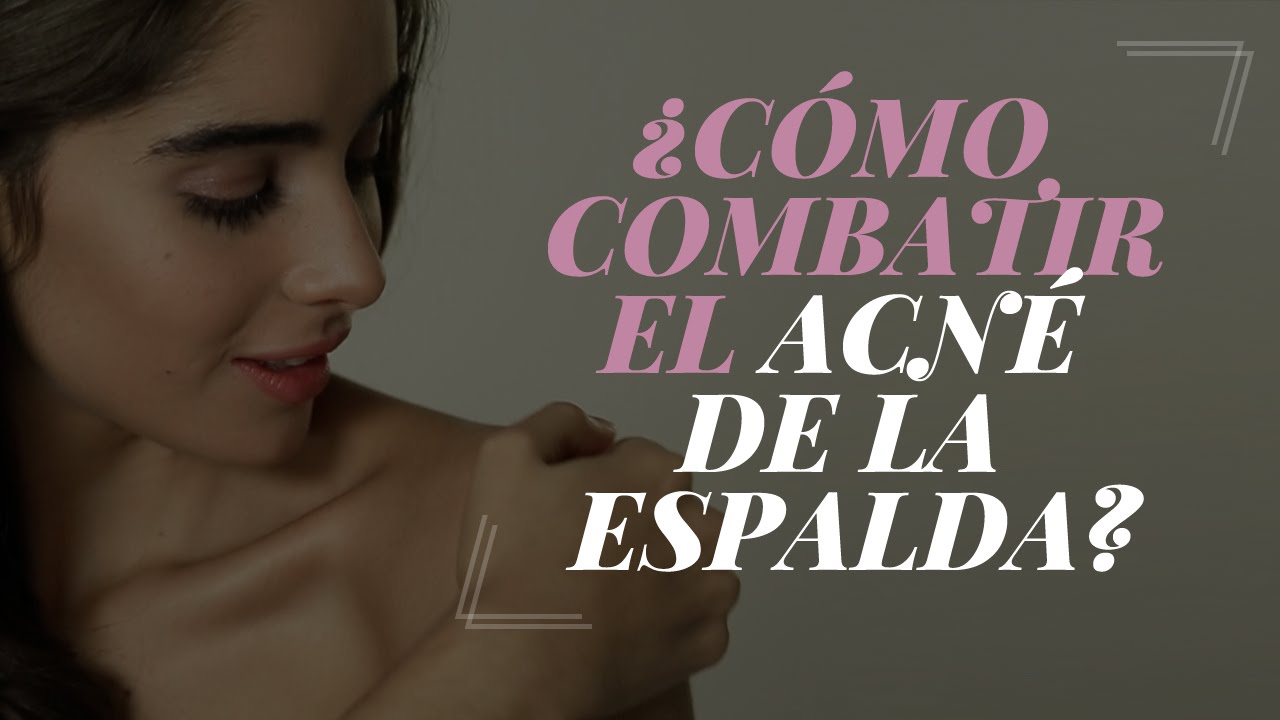 ¿Cómo combatir el acné de la espalda?