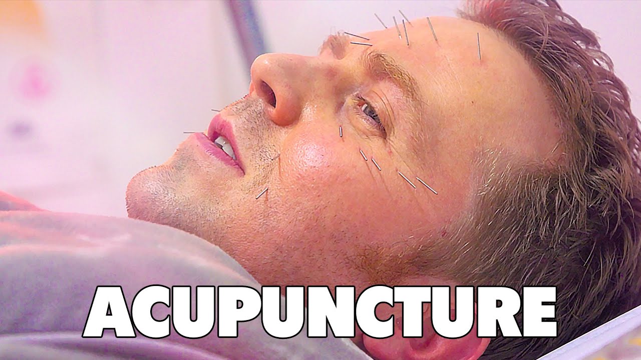 Gareth Reynolds Sticks Needles In His Face | Gareth Learn Things