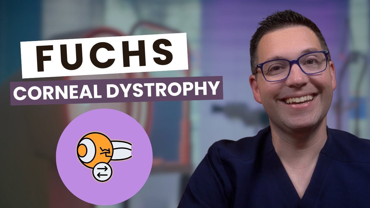 Защитите свое зрение: объяснение дистрофии Фукса