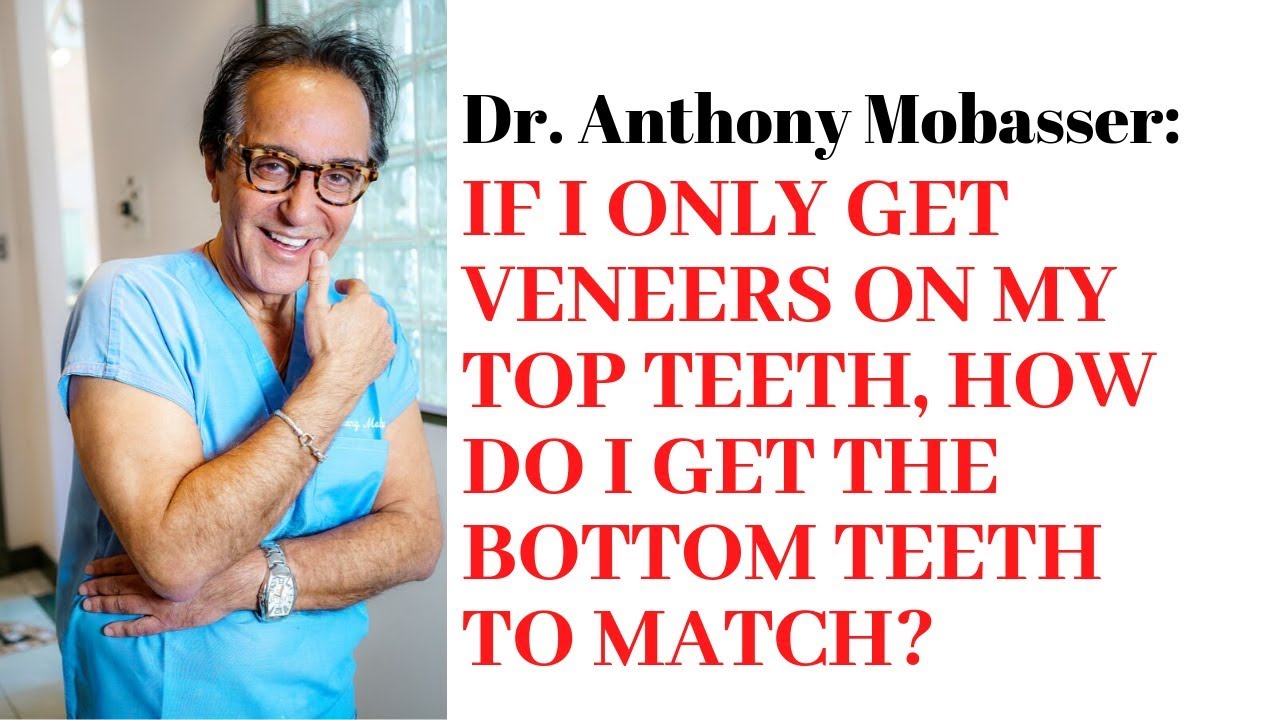 If I only get veneers on my top teeth, how do I get the bottom to match? | Dr. Anthony Mobasser