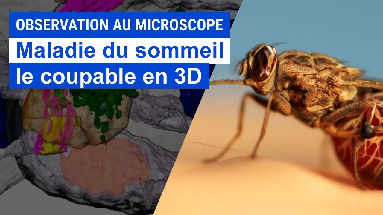 La maladie du Sommeil avec Philippe Bastin