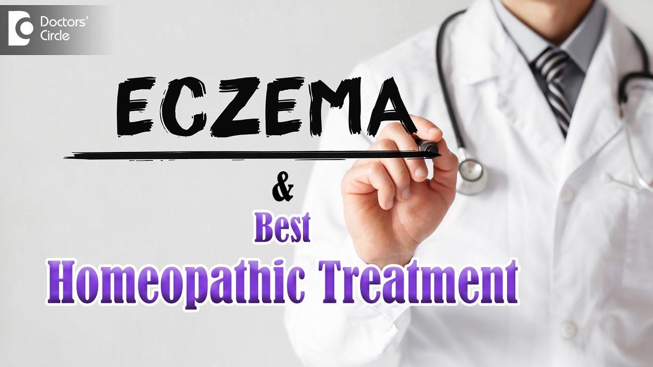 Eczema Causes: Symptoms & Homeopathic Management - Dr. Sanjay Panicker | Doctors' Circle