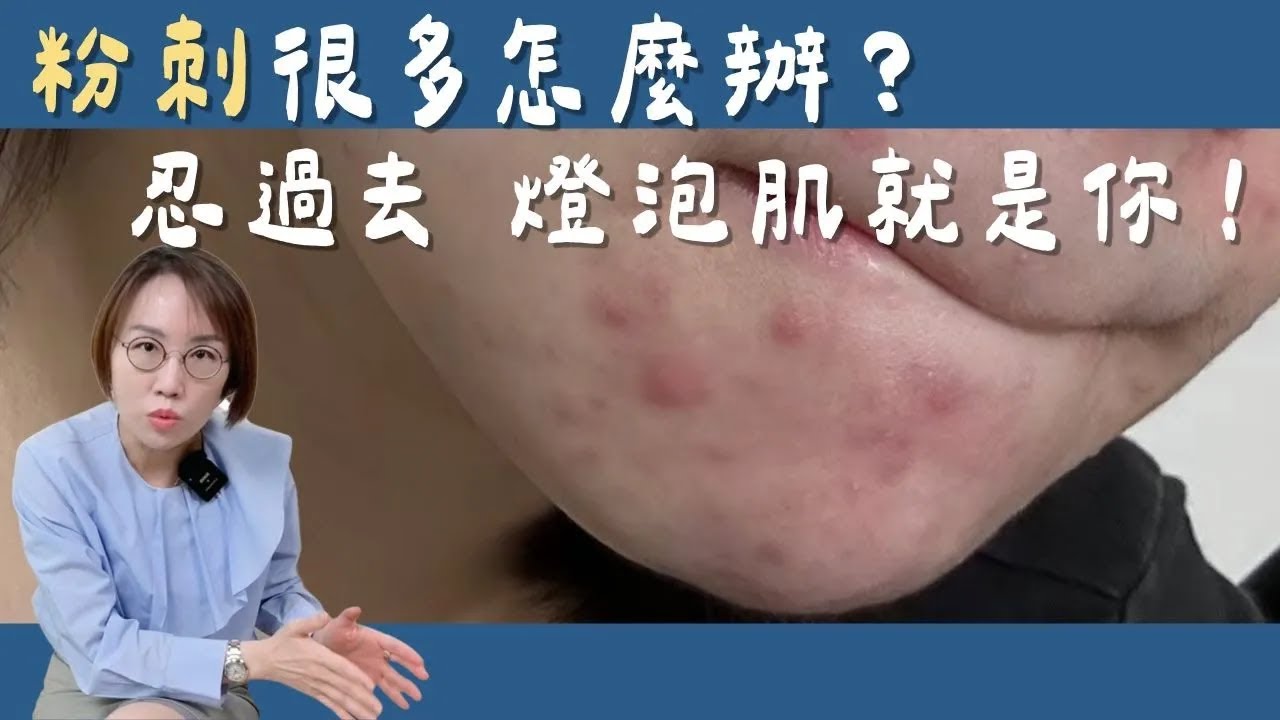 擦A酸爆痘為什麼找上門？A醇不脫皮進階擦法！燈泡肌很簡單！