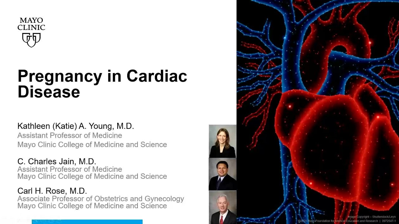 Pregnancy in Cardiac Disease