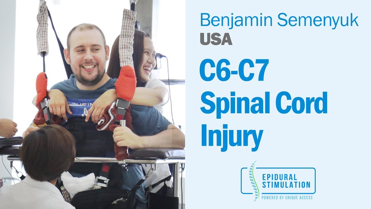 Benjamin, C6 SCI patient, is regaining strength and control with Epidural Stimulation