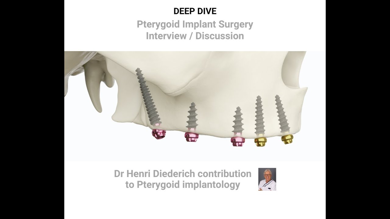 PTERYGOID SURGICAL Deep dive with experts