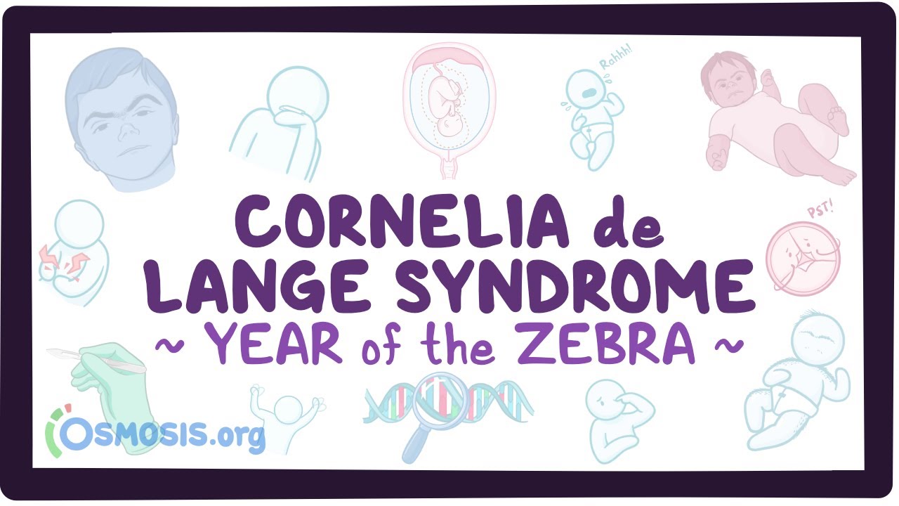 Cornelia de Lange syndrome (Year of the Zebra)