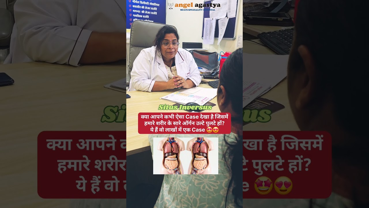 Rare Case of Situs Inversus &  Dextrocardia| OPD talk| Dr. Kalpana Aggarwal