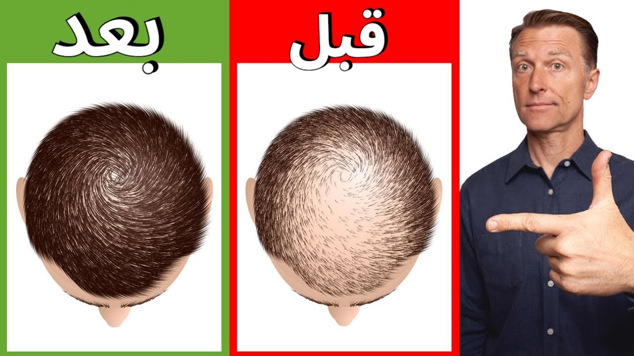 12 وَصْفَةً طَبِيعِيَّةً لِلتَّخَلُّصِ مِنْ تَسَاقُطِ الشَّعْرِ وَجَعْلِهِ قَوِيًّا وَجَمِيلًا