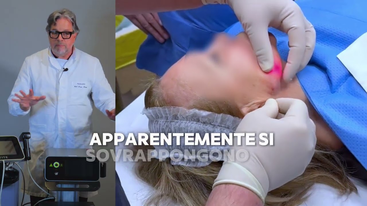 Endolift  – Trattamento Mini-Invasivo per il Ringiovanimento del Viso | Dott. Bruno Bovani