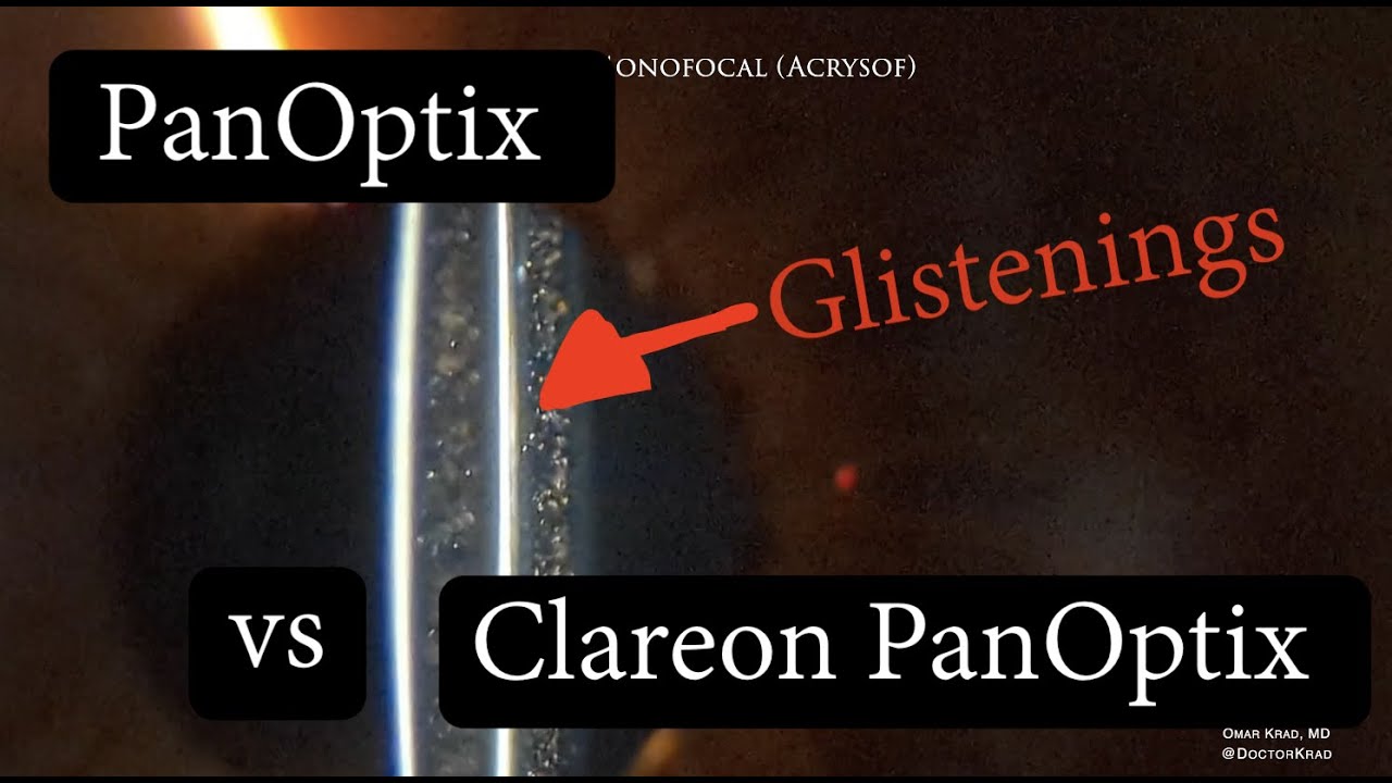 PANOPTIX vs CLAREON PANOPTIX.  Difference in Glistenings?