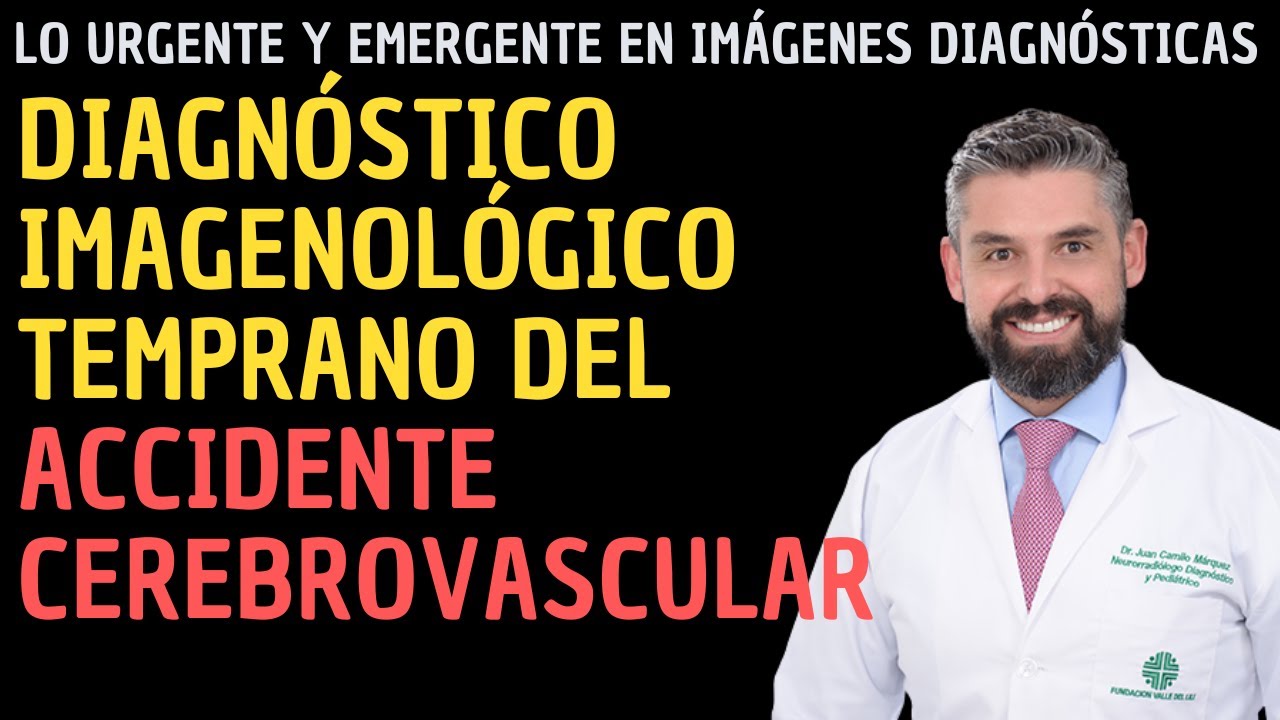 Diagnóstico imagenológico temprano del accidente cerebrovascular (ACV)