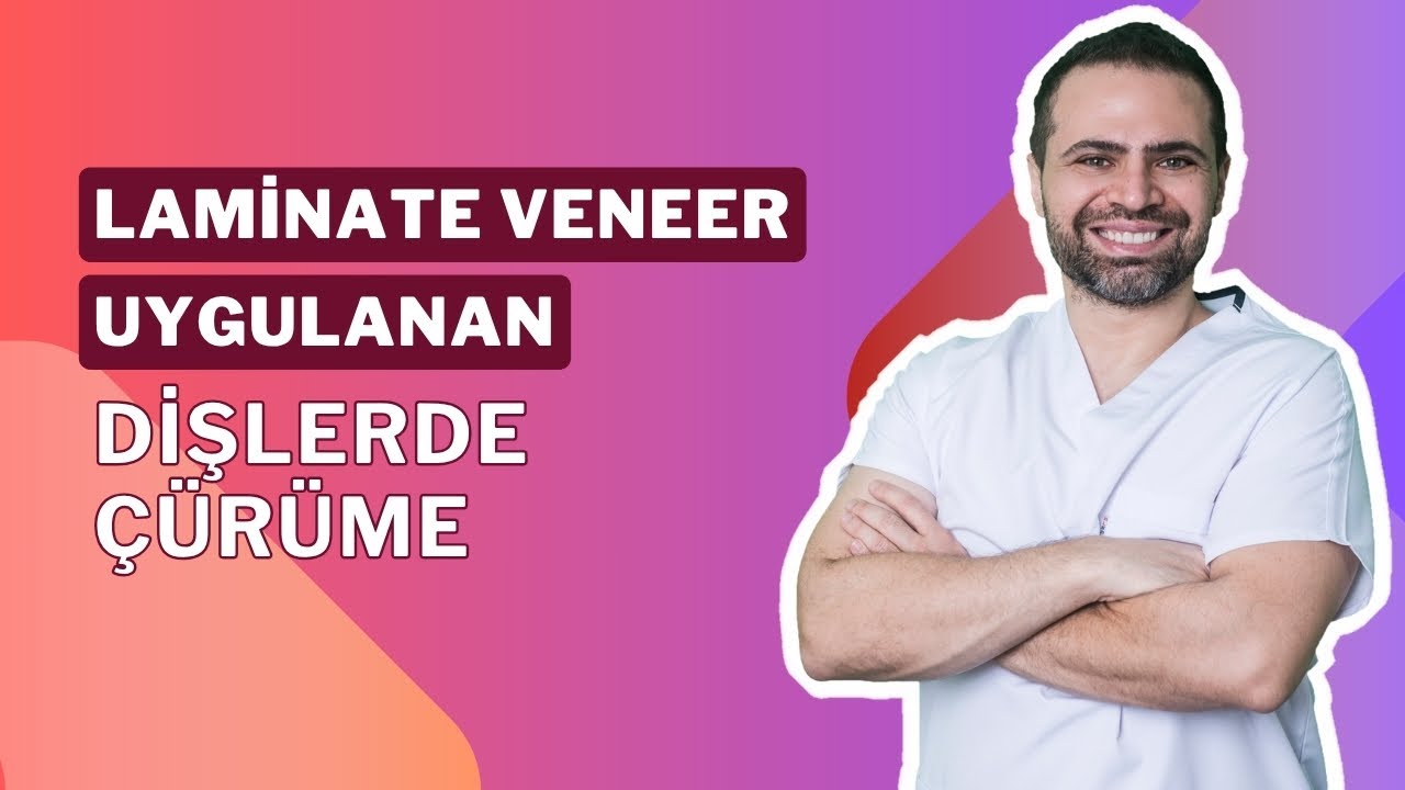 Laminate Veneer Uygulanan Dişlerde Çürüme