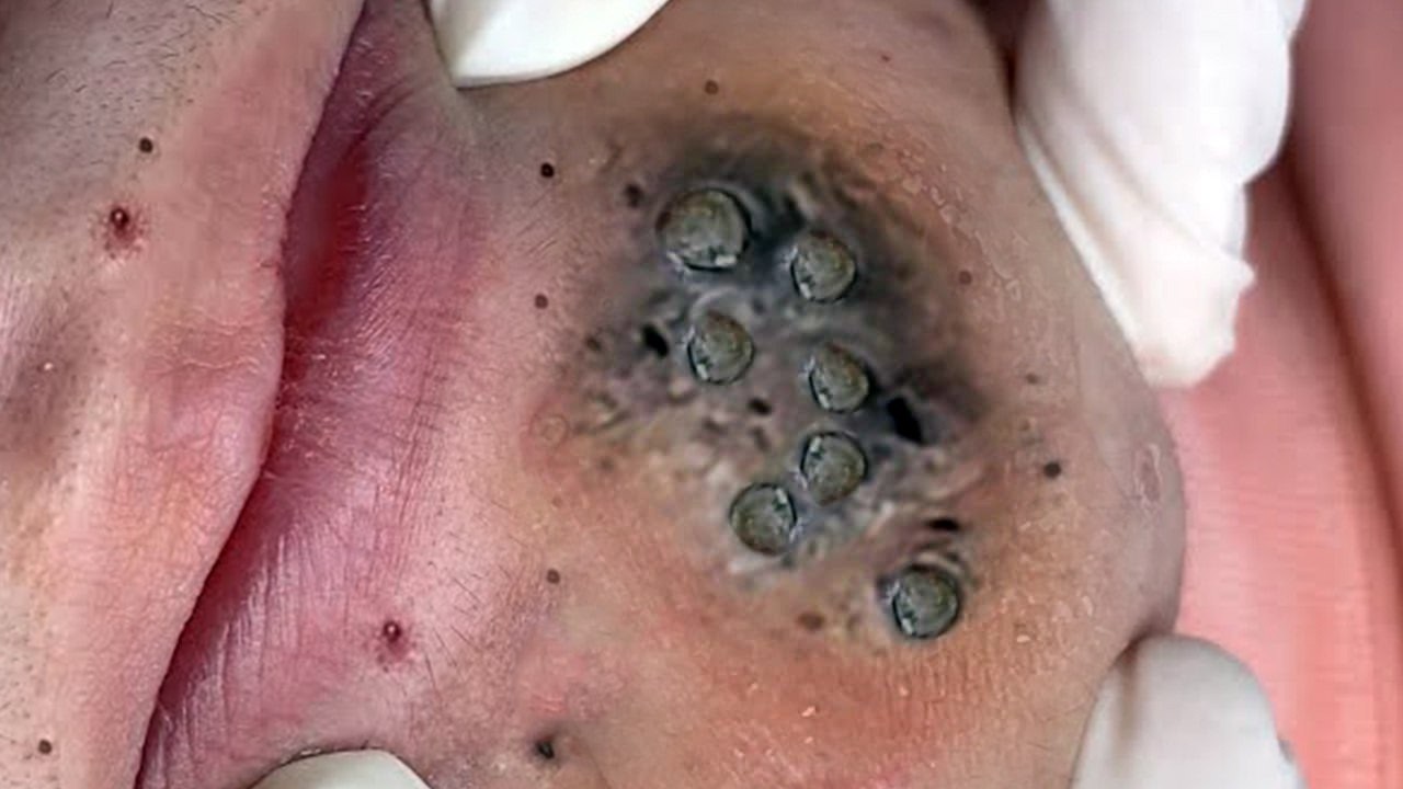 𝑨𝒄𝒉𝒊𝒆𝒗𝒆 𝑰𝒏𝒏𝒆𝒓 𝑷𝒆𝒂𝒄𝒆 𝑾𝒊𝒕𝒉 𝑻𝒉𝒆𝒔𝒆 𝑭𝒂𝒄𝒊𝒂𝒍 𝑪𝒍𝒆𝒂𝒏𝒔𝒊𝒏𝒈 𝑴𝒆𝒕𝒉𝒐𝒅𝒔 #9008396