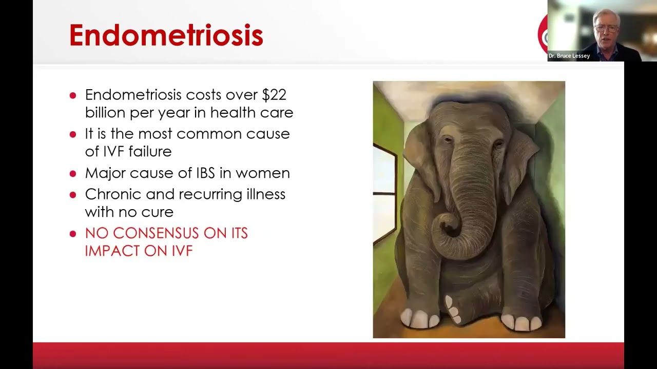 ASRM Topic of the Month: First-Line Approach to Endometriosis-Related Infertility:  Surgery or ART?