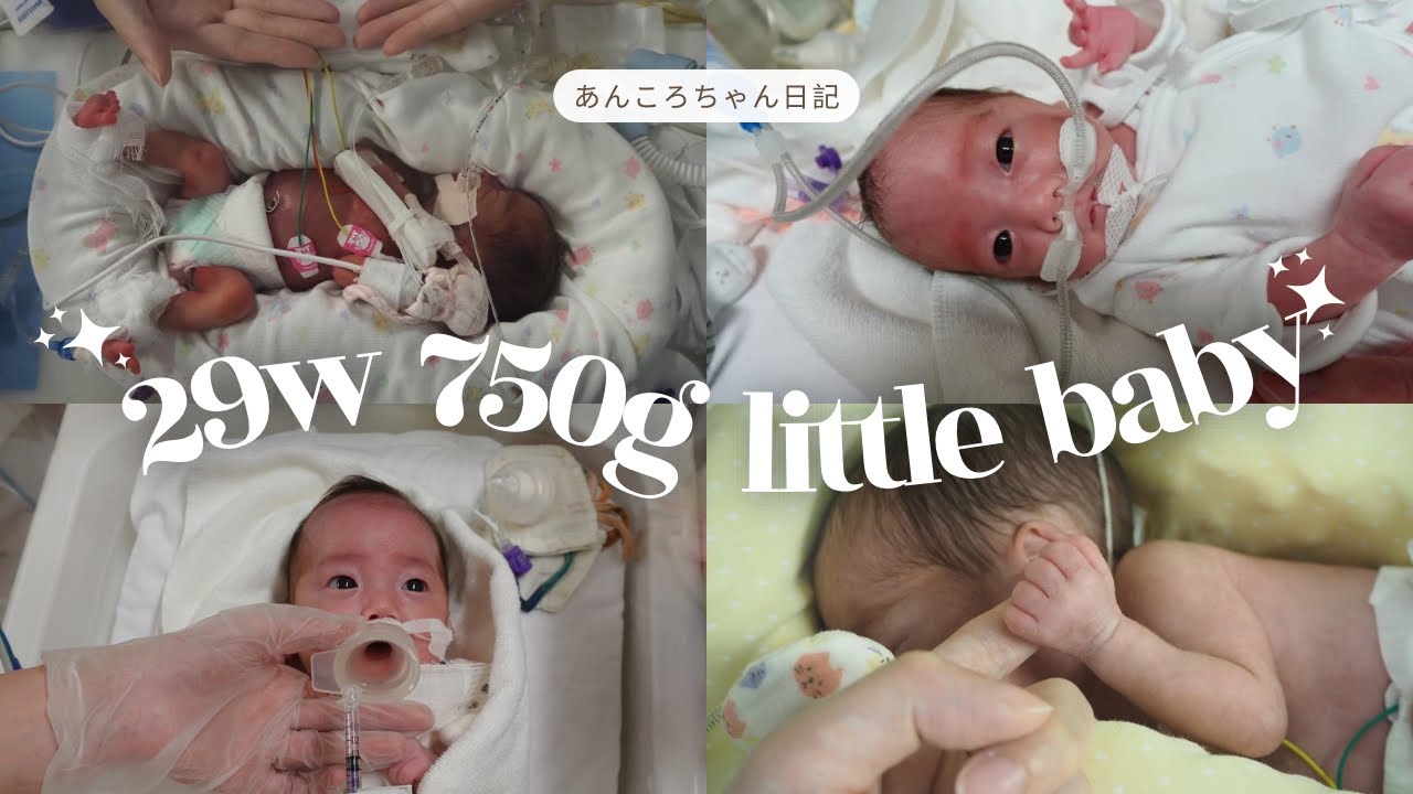 【超低出生体重児】29w 750gで産まれた娘の軌跡