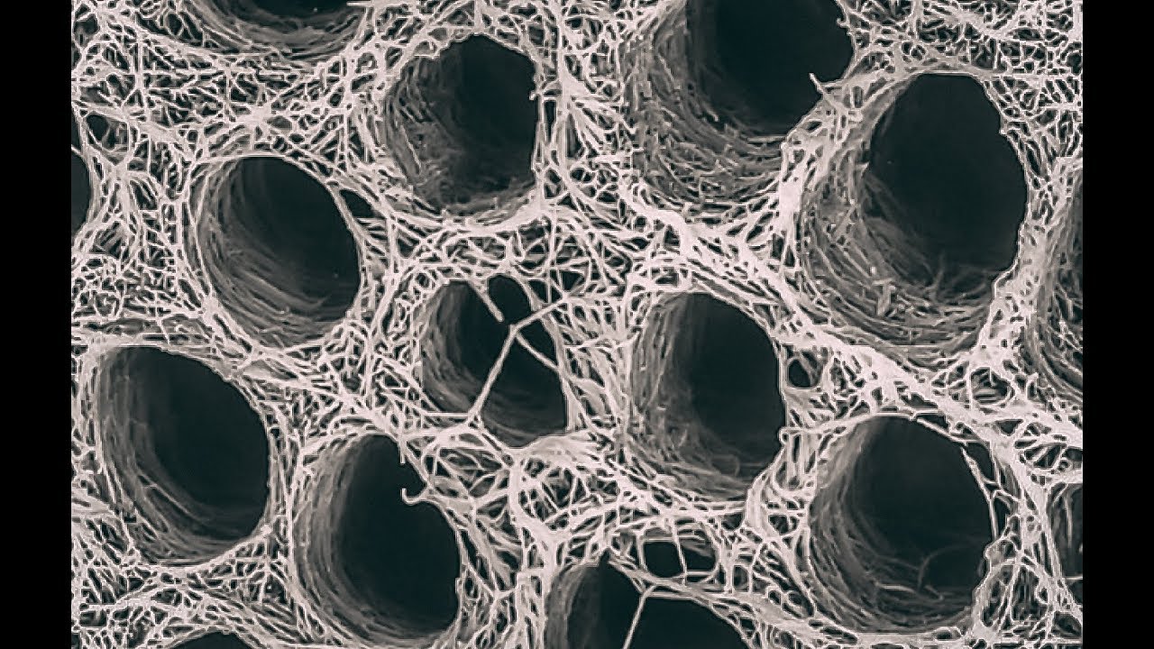 5 Things You Should Know About Immediate Dentin Sealing