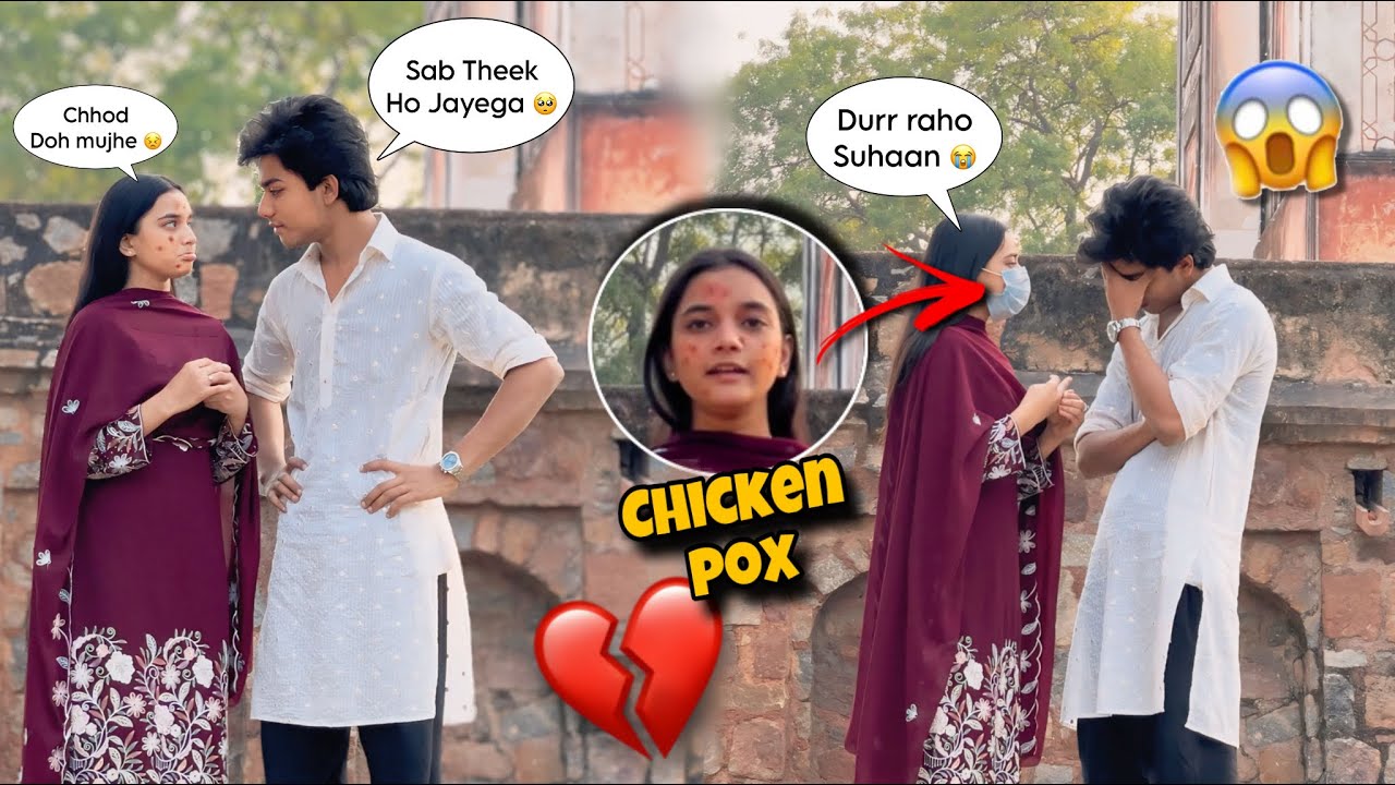 Chicken Pox Prank On Suhaan💕| Prank Gone Emotional😓| Dangerous Prank Ever ☠️