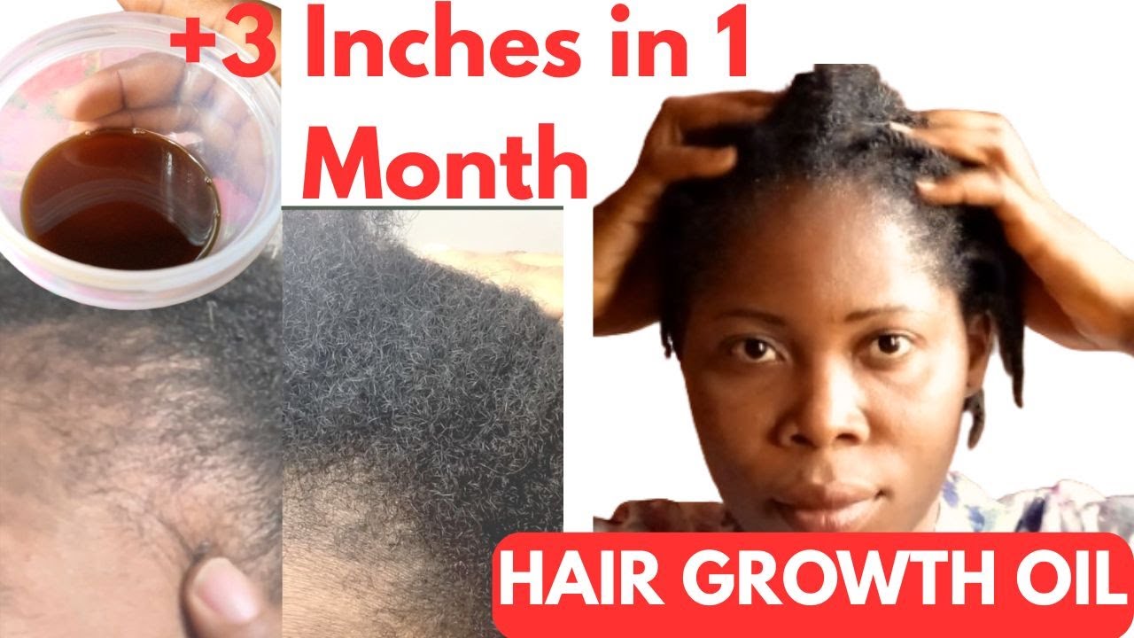 This DIY Oil Regrew My Edges and Hair Faster and Thicker in 2 Weeks | Clove + Onion for Hair Growth”