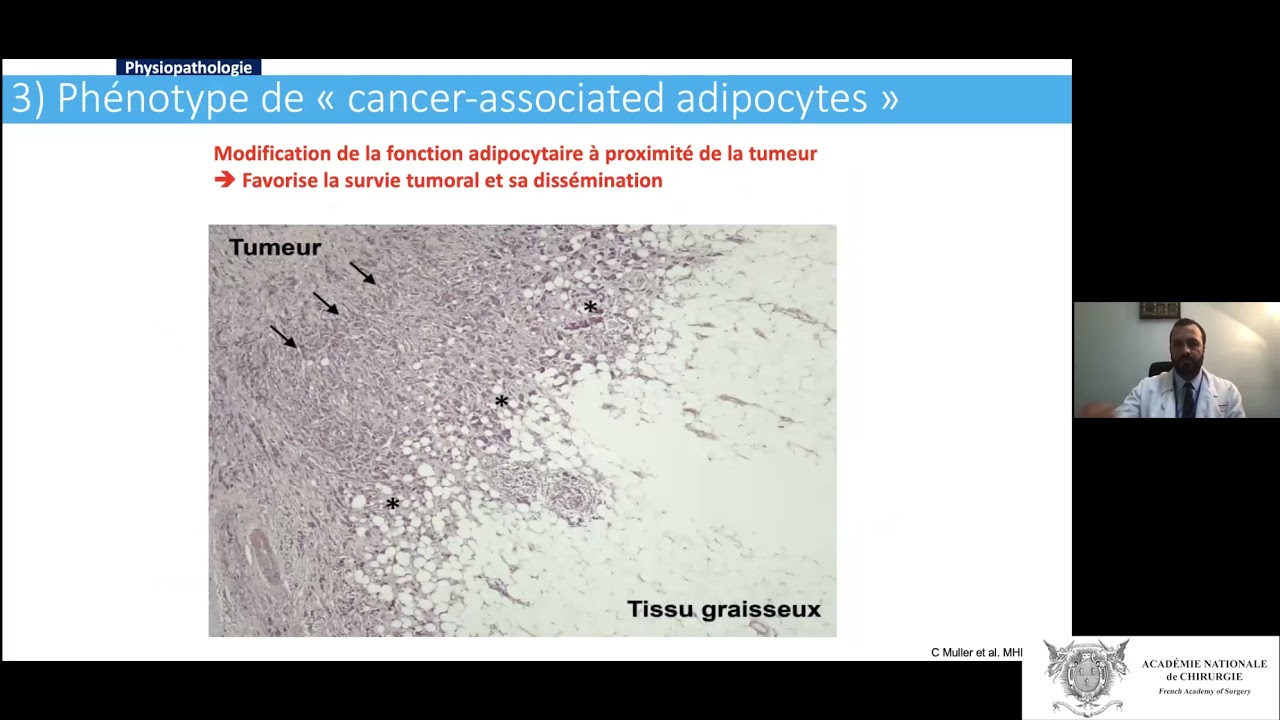 Impact de l'obésité sur l'incidence et la prise en charge des cancers digestifs