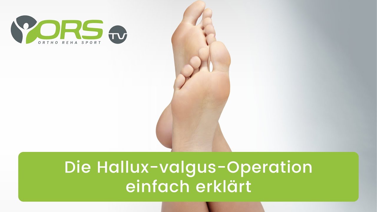 Die Hallux-valgus-Operation einfach erklärt