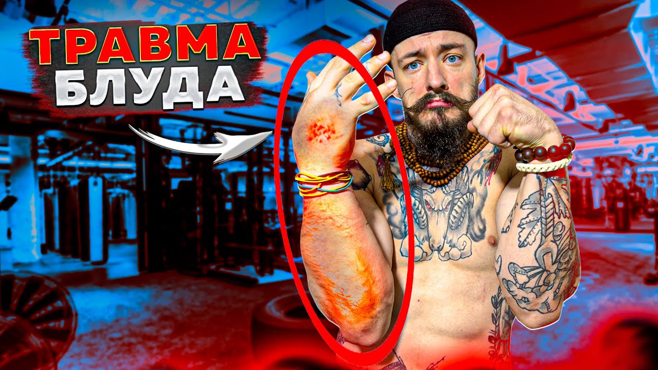 ТРАВМА ВИКТОРА БЛУДА