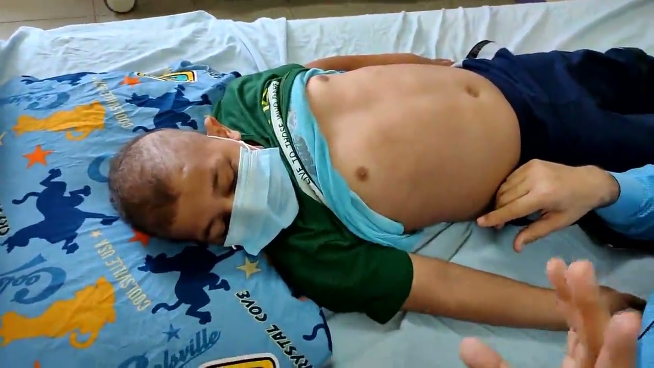 Abdomen examination in  pediatrics