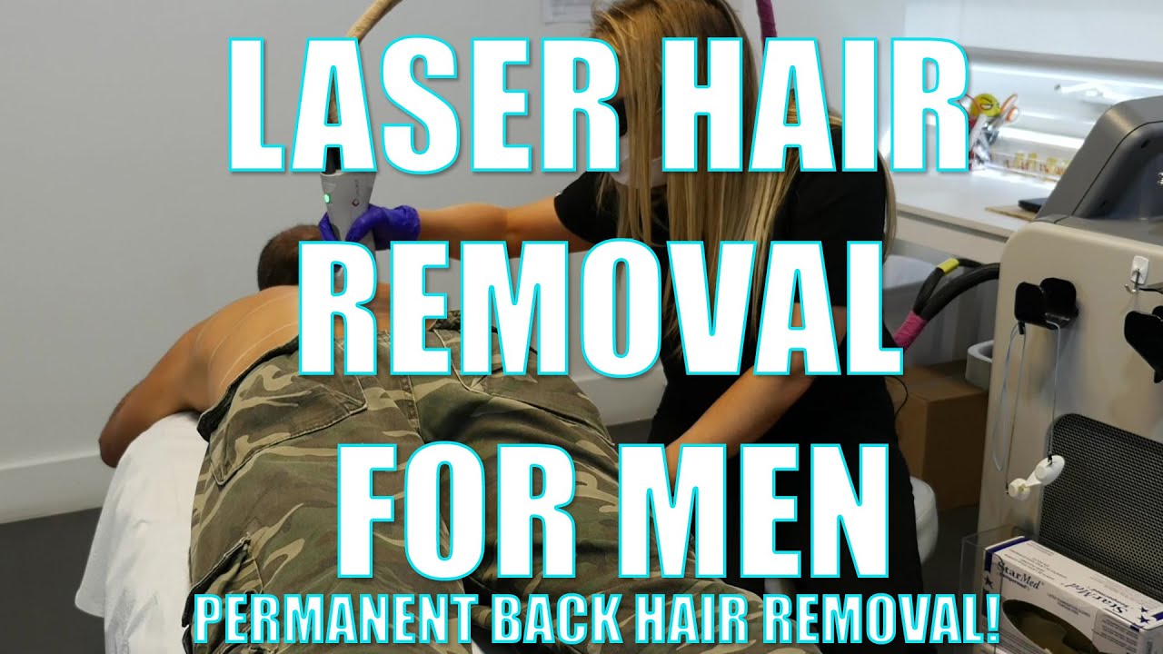 Male Laser Hair Removal - Laser Back Hair Removal for Men - Arviv Aesthetics Tampa