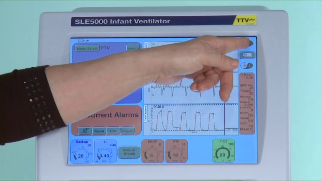 SLE5000 | 10. Patient Triggered Modes of Ventilation