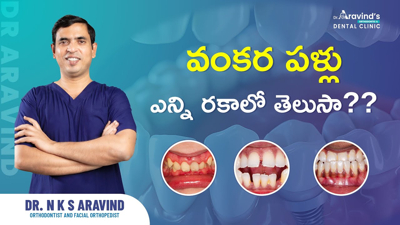 వంకర పళ్లు ఎన్ని రకాలో తెలుసా??
