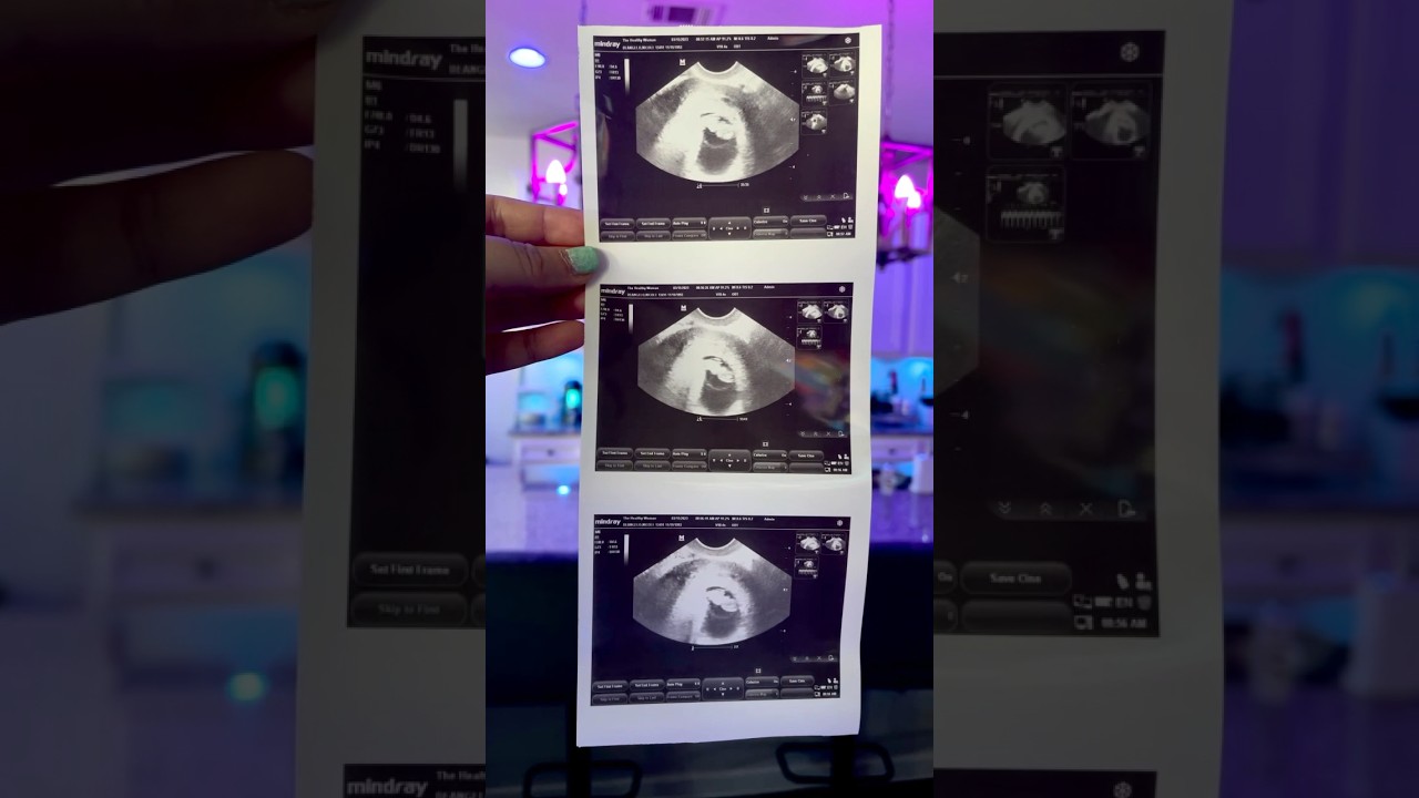 Our Rainbow Baby 🙏🏽🌈 #rainbowbaby #pregnancyjourney #pregnancy #miscarriageawareness #pregnant